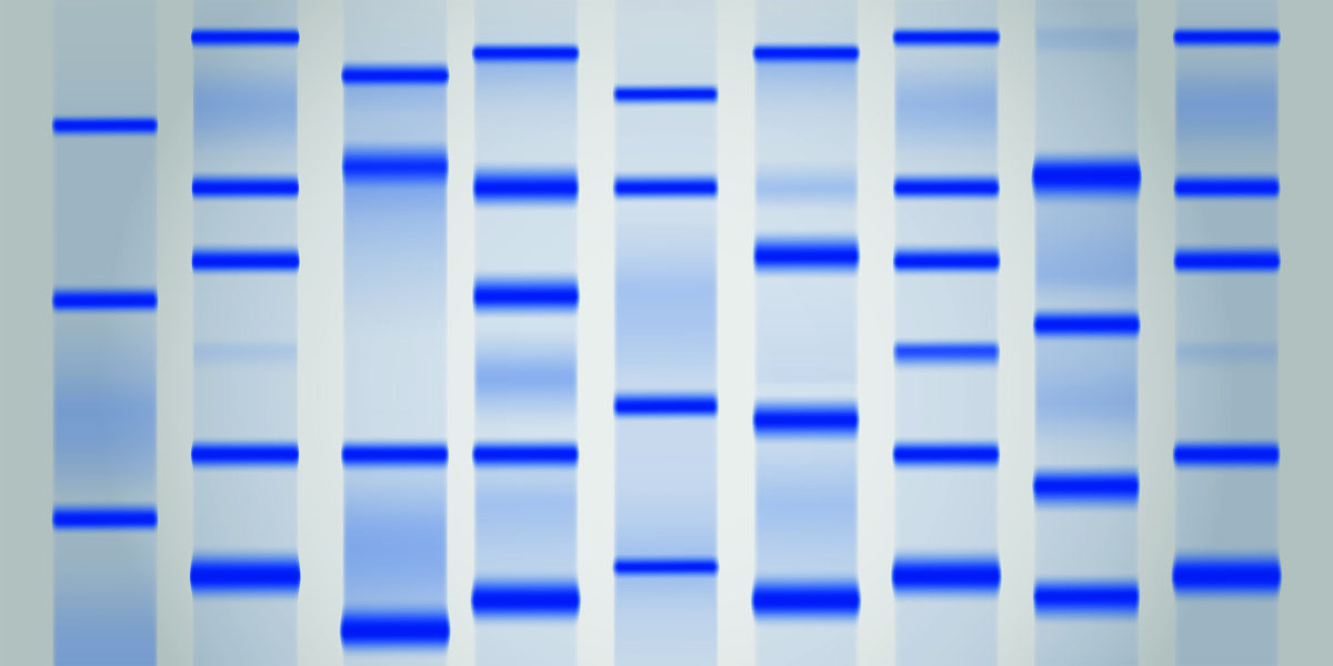 Precast Protein Gels NIPPON EUROPE