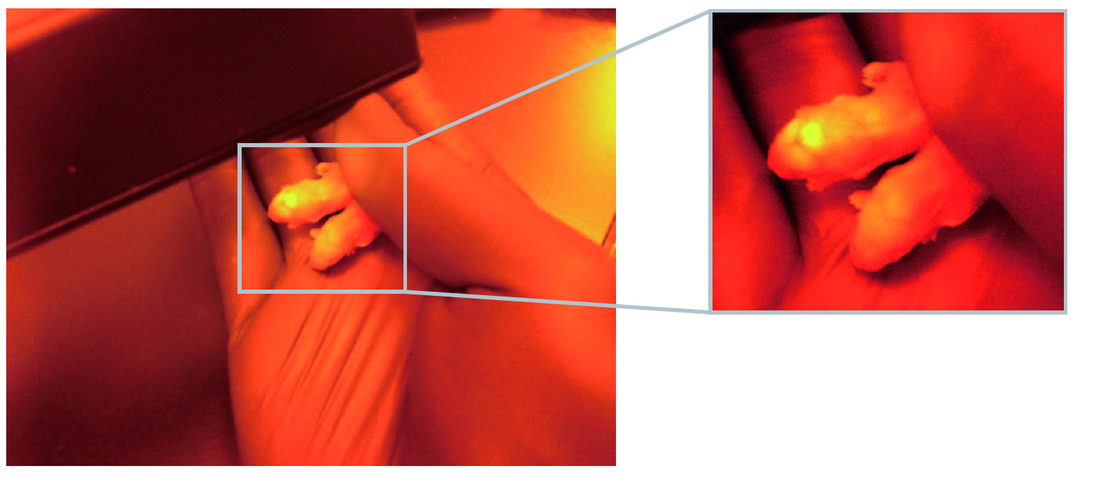 GFP detection in vivo using LEDs